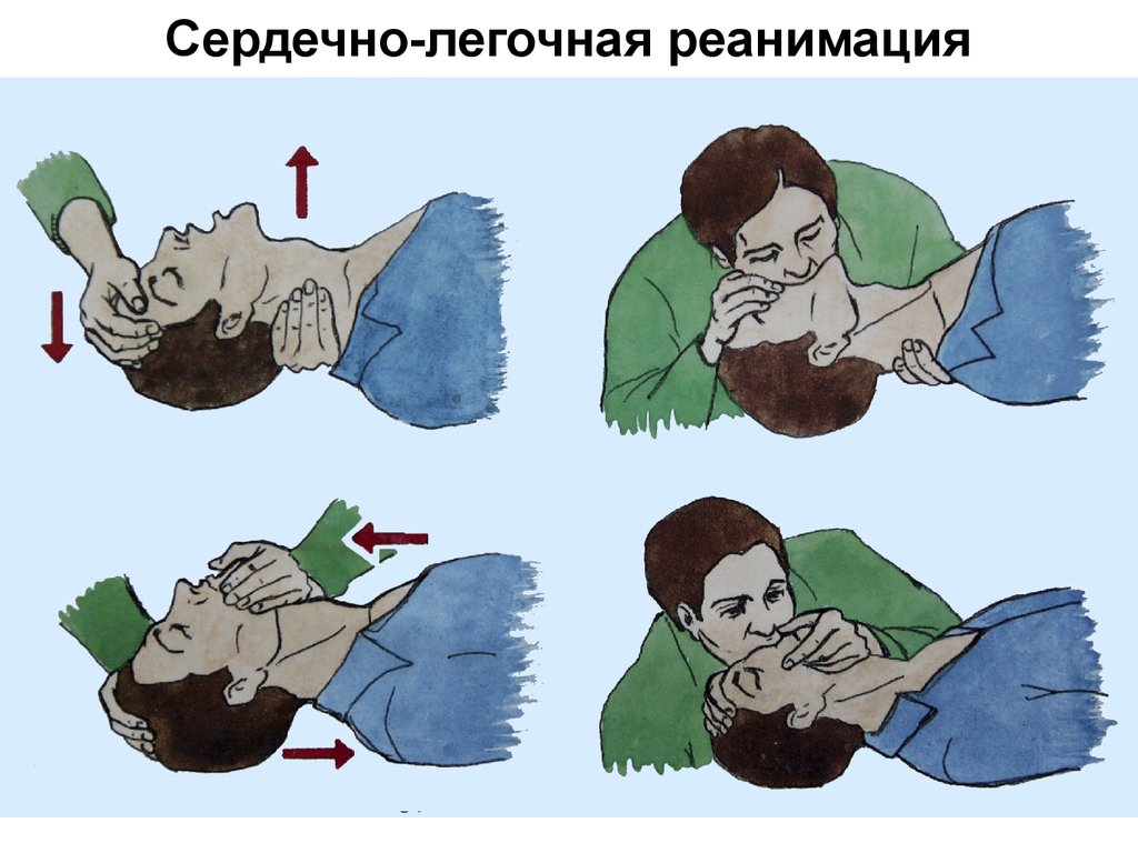 Первая помощь